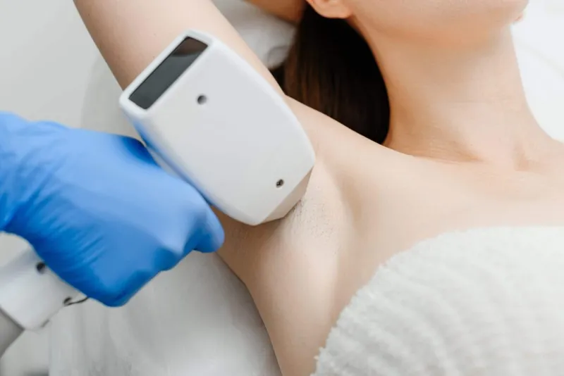 Laser Hair Removal Benefits
