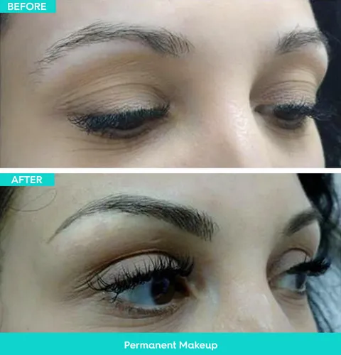 Permanent makeup before and after result 1 at Arviv Medical Aesthetics