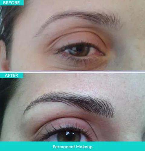 Permanent makeup before and after result 2 at Arviv Medical Aesthetics
