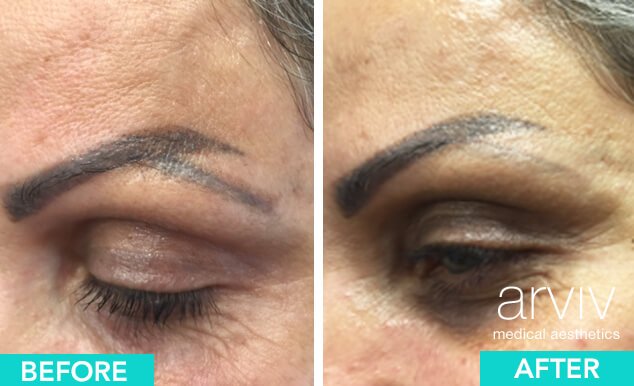 Permanent Makeup Treatment: Types, Process and Cost