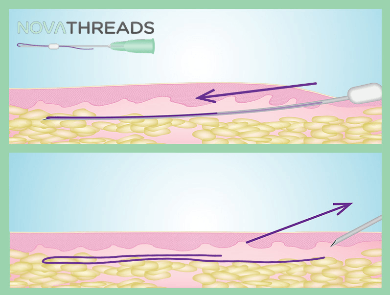 NovaThreads PDO Threading