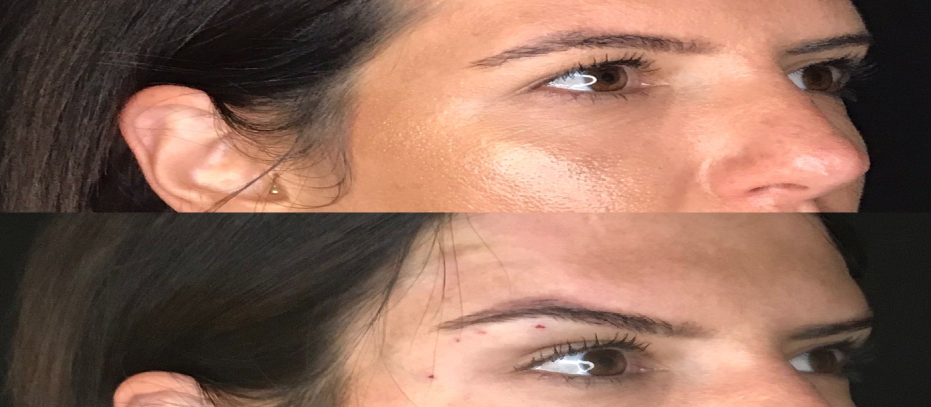 Natural eye clearance lift