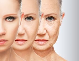 los angeles anti aging microneedling 300x234 1