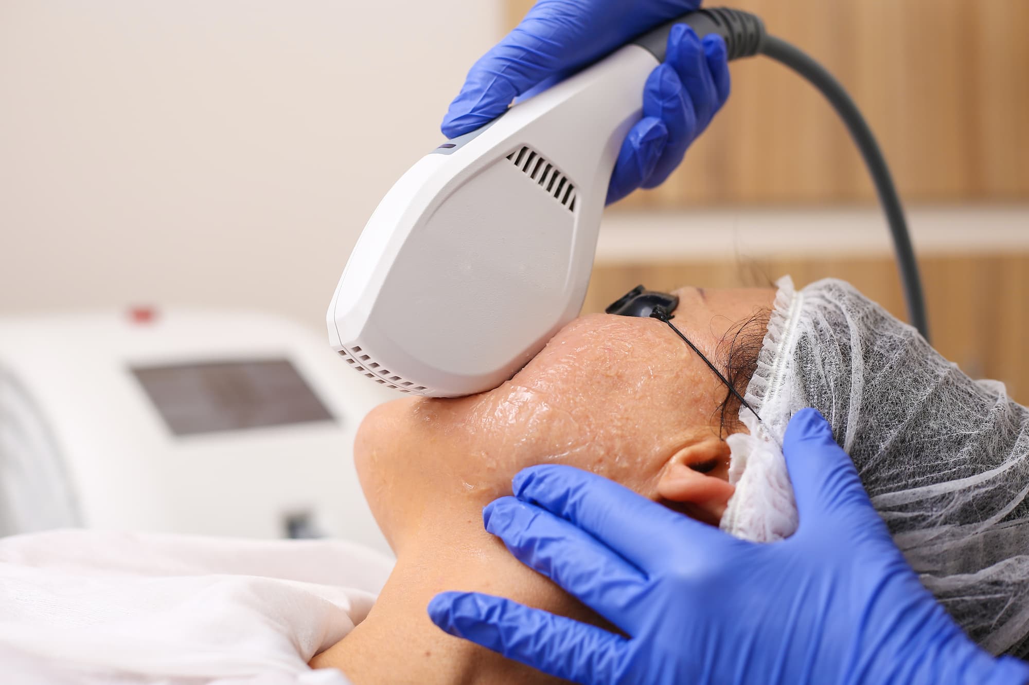 IPL Hair Removal Treatments - Peoria, AZ: Fisher Medical