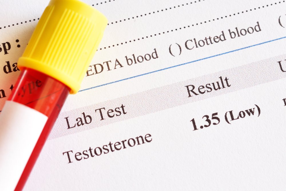Testosterone Lab Test Results