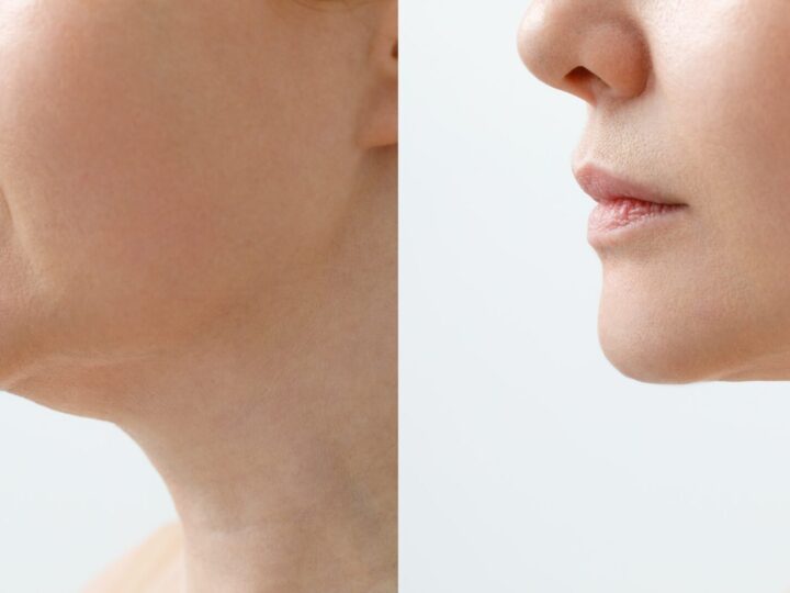 How to Tighten Neck Skin: Top Tips & Procedures