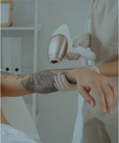 Eliminación de tatuajes con láser