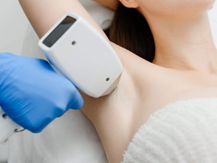 Laser Hair Removal